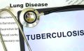 Health Workers Embrace New Digital Tool to Combat TB